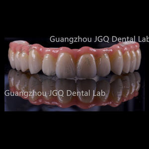 Support d'implant Restaurations dentaires Pont <span class=keywords><strong>en</strong></span> <span class=keywords><strong>zircone</strong></span> vissé avec barre <span class=keywords><strong>en</strong></span> titane Laboratoire <span class=keywords><strong>dentaire</strong></span> chinois - Product Image 2