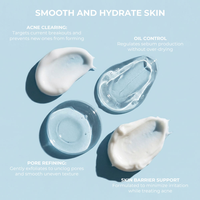 Set de Cuidado de la Piel Antiacné con Peróxido de Benzoilo al 5% OEM, Gel y Cosmético con Peróxido de Benzoilo, Cremas Hidratantes y Calmantes para el Acné, Kit de Cuidado Facial