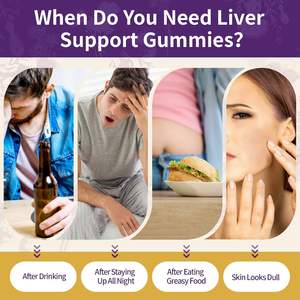 อาหารเสริมซิลิมาริน 2000 มก. แบบกัมมี่ ยี่ห้อ OEM บำรุงตับ ด้วยสารสกัดจากมิลค์ทิสเทิล ผสมอาร์ติโชค แดนดิไลออน และขมิ้นชัน - Product Image 6