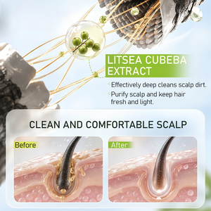 Savon solide pour cheveux Icesea Litsea Cubeba fait à la main, antipelliculaire, pour un cuir chevelu rafraîchi - Product Image 6