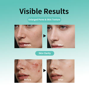 Productos para el Cuidado de la Piel con PDRN de Marca Privada, Serie Iluminadora, Hidratación Profunda y Barrera Cutánea, Tónico, Crema, Set PDRN - Product Image 2