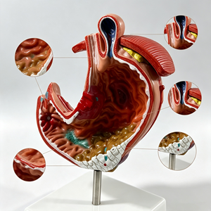 Modelo de Estómago Patológico SCIEDU para la Enseñanza de la Anatomía del Sistema Digestivo Humano - Product Image 3