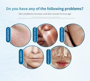 Máquina de electroporación en caliente y frío para la piel facial Croyo, dispositivo para estiramiento facial, 1 unidad - Product Image 4