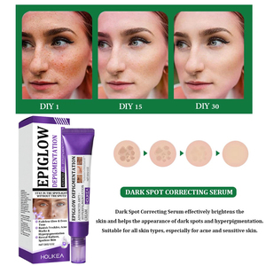 Crème de soins de la peau pour blanchir les taches de rousseur élimination de la pigmentation réparation rapide de la mélanine éclaircir la niacinamide livraison directe - Product Image 2