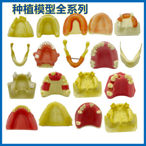 Modelo de Implante Dental, Simulador de Levantamiento de Seno Maxilar, Modelo de Entrenamiento con Encía Suave, 6x7.2x2.7cm, 67g - Product Image 5