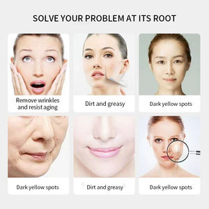 เครื่องวิเคราะ<span class=keywords><strong>ห</strong></span>์ผิวอัจฉริยะ มัลติฟังก์ชั่นสำ<span class=keywords><strong>ห</strong></span><span class=keywords><strong>รับ</strong></span>ผิว<span class=keywords><strong>ห</strong></span>น้า - RF ยกกระชับผิว ออกซิเจนเจ็ทพีล บำรุงผิว <span class=keywords><strong>ห</strong></span>น้าจอสัมผัส แบบพกพาสำห<span class=keywords><strong>รับ</strong></span>ใช้ในเชิงพาณิชย์ในส<span class=keywords><strong>ห</strong></span>รัฐอเมริกา - Product Image 6