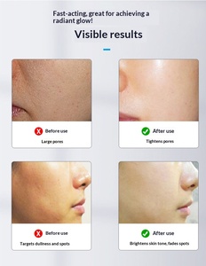 Machine Hydra Facial Certifiée CE Sans Taxe pour Éclaircir la Peau et Réduire les Rides - Product Image 6