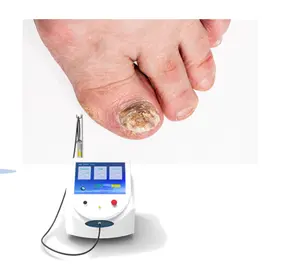 Fabricante fornece dispositivo de laser de diodo 980nm para esterilização de unhas e terapia de unhas, tratamento de onicomicose, de alta qualidade