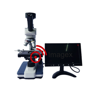 <span class=keywords><strong>Microscope</strong></span> d'analyse <span class=keywords><strong>de</strong></span> sang en temps réel à <span class=keywords><strong>contraste</strong></span> <span class=keywords><strong>de</strong></span> <span class=keywords><strong>phase</strong></span> en champ noir pour la recherche en santé - Product Image 6