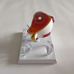 Modelo Anatómico Patológico del Ojo Humano, Modelo de Exhibición de Enfermedades de la Córnea para Enseñanza Médica - Product Image 5