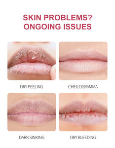 Masque Lèvres en Gelée Rose au Collagène et à l'Acide Hyaluronique Végétalien, Parfum Pêche, Forme Lèvres, Vente en Gros Usine - Product Image 3