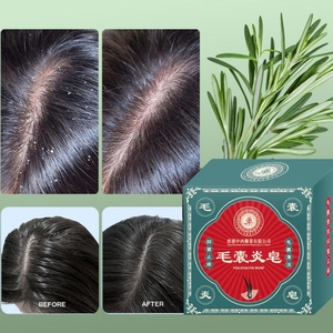 Jabón de foliculitis del cuero cabelludo multiefecto: fórmula <span class=keywords><strong>natural</strong></span> para la eliminación de ácaros, la limpieza del acné y el cuero cabelludo saludable - Product Image 1