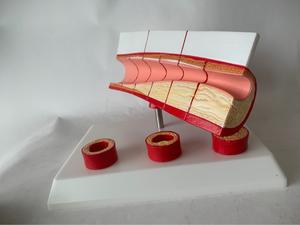 एनाटोमिकल चिकित्सा विज्ञान मानव संवहनी घावों प्रदर्शन मॉडल संवहनी ओक्शन मॉडल - Product Image 4