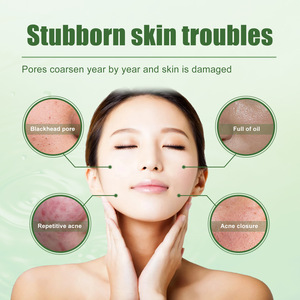 เซาท์มูน แอนตี้-แอคเน่ เฟเชียล เจล ลดรอยสิว ปิดรูขุมขน ทำความสะอาดผิว และปรับสภาพผิวที่มีปัญหา<span class=keywords><strong>สิว</strong></span> 30 มล. - Product Image 3