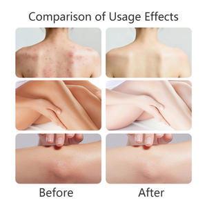 Savon éclaircissant personnalisé à l'acide kojique pour estomper les taches <span class=keywords><strong>solaires</strong></span> ; Savon blanchissant à la niacinamide pour éliminer la pigmentation - Product Image 5