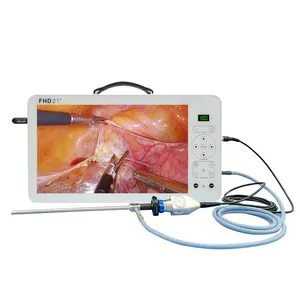 Производитель эндоскопии shrek, медицинская эндоскопическая система fhd с 21-дюймовым монитором и записью