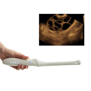 Escáner <span class=keywords><strong>de</strong></span> Ultrasonido Doppler Transvaginal Inalámbrico CProbe-4T, 96 Elementos, 32 Canales, para Examen <span class=keywords><strong>Vaginal</strong></span> - Product Image 3