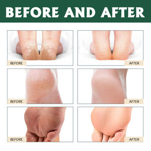 Soin des pieds Gommage au sucre Bain exfoliant Nettoyage en profondeur Hydrater Blanchissant Soins de la peau Soins des pieds - Product Image 4