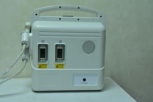 Échographe Doppler Couleur Portable DMU48 Haute Performance pour Diagnostic de Base, Idéal pour les Cliniques Privées - Product Image 5