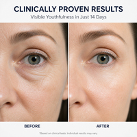 Kit de soin des yeux pour réduire les rides, les poches, les cernes et les rides sous les yeux, produits de soin de la peau coréens pour salons de beauté, masque pour les yeux au collagène
