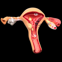 Modèle d'ovaire, modèle anatomique de l'organes reproducteurs féminins, outil éducatif médical