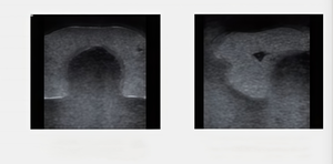 Module de ponction thyroïdienne guidée par ultrasons, modèle d'entraînement à l'anatomie humaine - Product Image 5