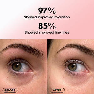 Patchs Hydrogel au Collagène pour les <span class=keywords><strong>Yeux</strong></span> – Soin Anti-Cernes et Anti-Âge – Prix de Gros – Produit Phare - Product Image 3