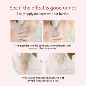 Desodorante OEM, antitranspirante, Etiqueta Privada, desodorante, fragancia vegana, desodorante blanqueador Natural, barra orgánica para mujer - Product Image 5