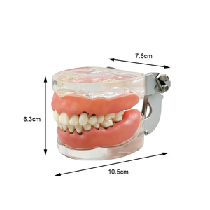 Model Gigi Resin Penyakit <span class=keywords><strong>Periodontal</strong></span> Model Gigi Anatomi untuk Mahasiswa Kedokteran Gigi Gusi Lunak Gigi Lepas Typodont Pasien - Product Image 6