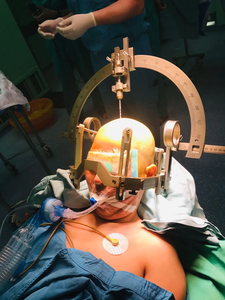Ultra-Präzisions technologie Neuro chirurgisches stereo taktisches Gehirn-System - Product Image 5