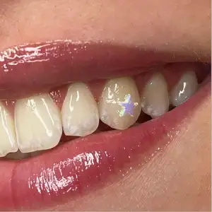 DIY hygiène buccale dentaire dos plat opale dent gemme diamant bijoux cristal dent gemmes populaires