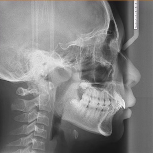Appareil d'imagerie <span class=keywords><strong>panoramique</strong></span> et céphalométrique à une touche pour une sortie d'images rapide, équipement d'imagerie spécialisé pour les cliniques dentaires - Product Image 4