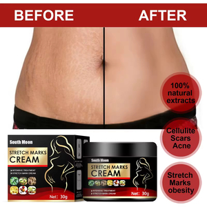 Vergeture 妊娠疤痕和妊娠纹去除身体霜 30g - Product Image 6