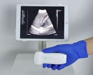 China Equipamento médico Wifi Color Doppler Probe Handheld Ultrasound Machine Scanner - Product Image 3