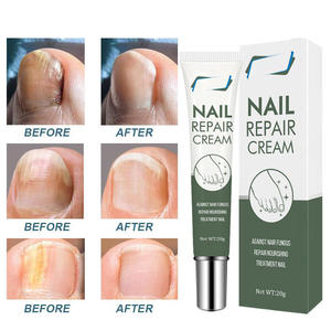 Crème réparatrice pour les ongles, <span class=keywords><strong>traitement</strong></span> antifongique léger et doux pour la peau, marque privée OEM/ODM, facile à utiliser, soin des pieds - Product Image 3