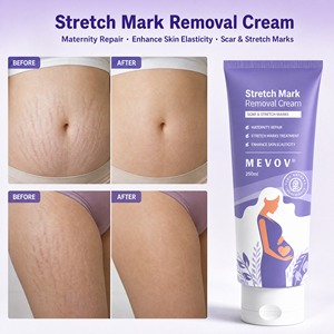 Crema elástica para tratamiento Natural, marca <span class=keywords><strong>de</strong></span> Estiramiento para la pergnancia corporal - Product Image 1