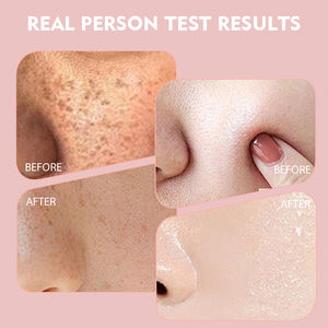 Crème de Nuit Éclaircissante et Hydratante pour le <span class=keywords><strong>Visage</strong></span>, Le <span class=keywords><strong>Meilleur</strong></span> de Thaïlande, à Base de Centella et Niacinamide pour Hommes et Femmes, Élimination des Taches Brunes, Vente en Gros - Product Image 5