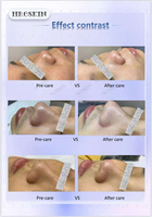 Appareil de microdermabrasion Aqua Hydro 10 en 1, nettoyage par bulles, dermabrasion H2O2, soin du visage pour salon