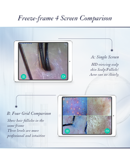 Meiboyi Sans Fil Portable Intelligent Wifi Cuir Chevelu Peau Santé Analyse Usage Domestique De Poche Cheveux Folicule Analyseur Scanner Machine - Product Image 5