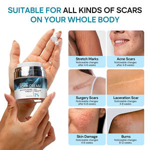 Removedor de cicatrices de acné de etiqueta privada Anti Vergeture Repair Productos de eliminación de cicatrices Crema de eliminación de cicatrices de acné fuerte y efectiva - Product Image 6