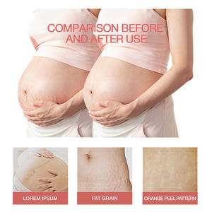 Huile Essentielle Réparatrice Prix de Gros : Huile Corporelle Hydratante et Liftante pour le Ventre, Atténuation des Lignes et Raffermissement, Huile Corporelle pour Tatouages Abdominaux - Product Image 3