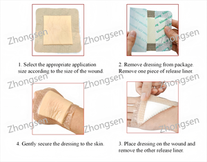 وسادة ضغط من الجل السيليكوني مرنة وذاتية اللصق لعلاج التهاب الجلد تستخدم لحماية وتنعيم الجروح - Product Image 3