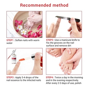 Esencia para Uñas LANBENA, Antihongos, Cuidado de las Uñas, Suero Reparador Nutritivo, Compatible con OEM - Product Image 3