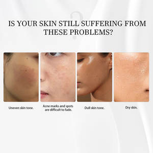 Sérum de visage de marque privée <span class=keywords><strong>Alpha</strong></span> Arbutine <span class=keywords><strong>2</strong></span>% blanchiment de la peau biologique réduit les taches acide hyaluronique <span class=keywords><strong>HA</strong></span> éclaircissant - Product Image 3