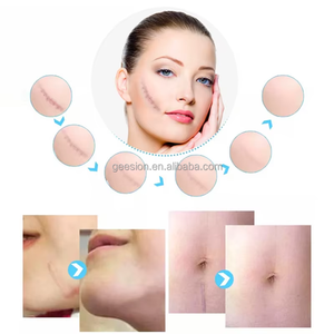 Hot Fornecedor Tiktok Hot Selling Silicone Sheets para Scar Completamente Reparação Vários Scar Tissues Scar Patches - Product Image 4