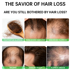 Ouhoe น้ำมัน<span class=keywords><strong>ผม</strong></span>สมุนไพรคุณภาพสูงป้องกันการหลุดร่วง | บำรุงให้แข็งแรง | ฟื้นฟูหนังศีรษะ | <span class=keywords><strong>ผม</strong></span><span class=keywords><strong>สุขภาพ</strong></span><span class=keywords><strong>ดี</strong></span>เรียบเนียน | สดชื่น - Product Image 6