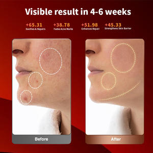 <span class=keywords><strong>EYCO</strong></span> Nouveautés Tendance Équipement de beauté à usage domestique Masque facial en silicone à LED Masque de thérapie par la lumière rouge pour les soins de la peau - Product Image 4