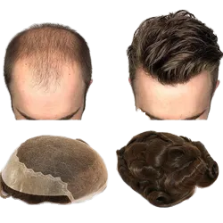 SuperThin Skin PU Base Grey #1B65 Q6 Virgin Remy Hair Patch Peluca <span class=keywords><strong>para</strong></span> hombres Cutícula Europea <span class=keywords><strong>Personas</strong></span> <span class=keywords><strong>mayores</strong></span> Cabello indio - Product Image 3