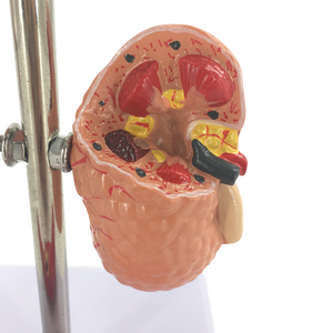 Анатомические модели для демонстрации диабета - Product Image 3