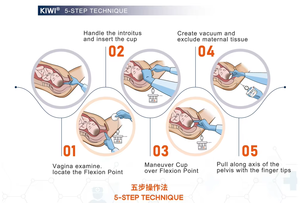 Système d'aspiration complet OmniCup Kiwi pour gynécologues, pour usage hospitalier Kiwi 0mni 5015G - Product Image 3